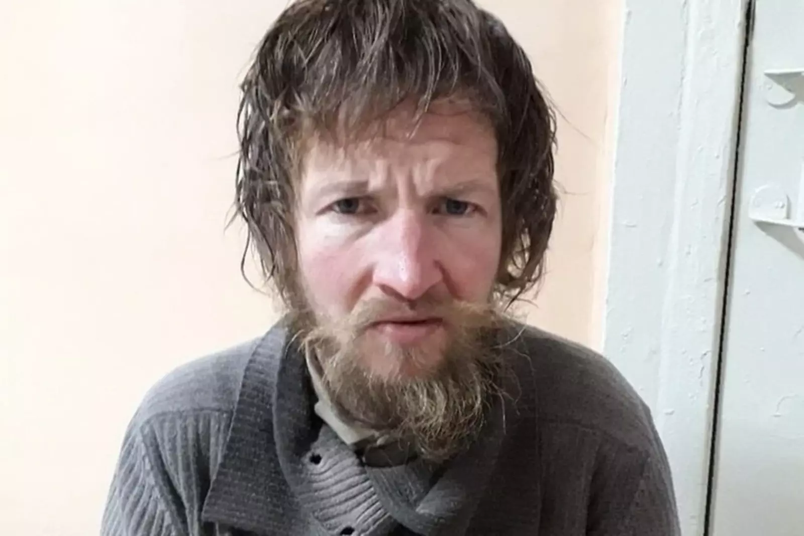 Гниющий заживо мужчина, которого спасали в Башкирии, уже давно путешествует по России